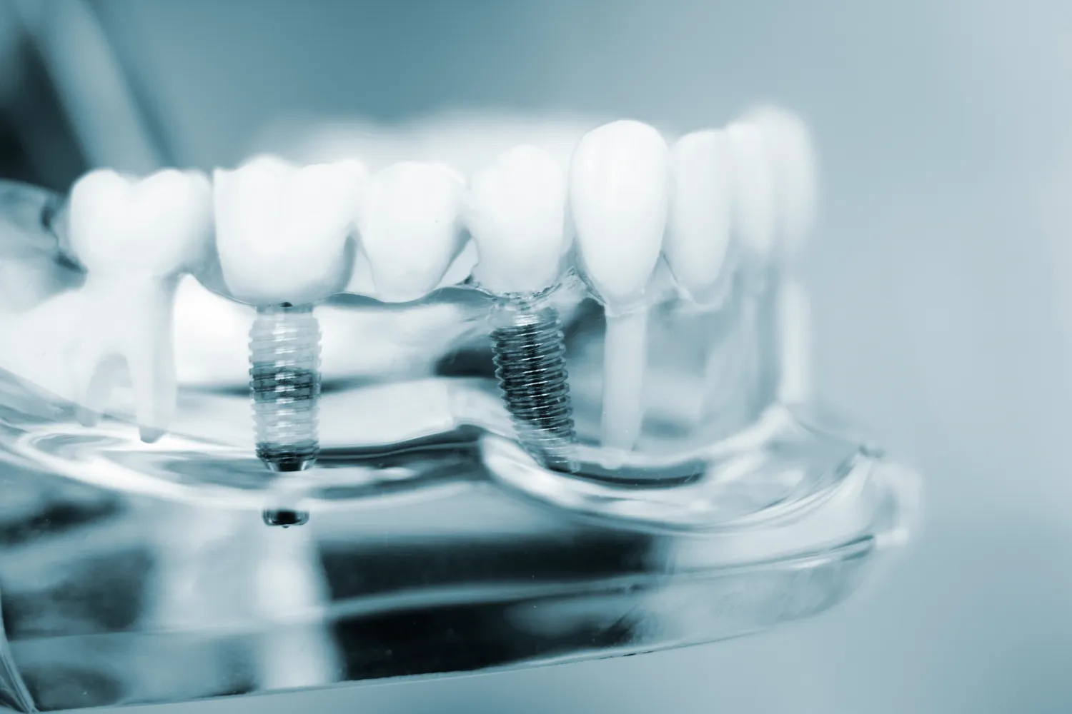 Wybór dobrego dentysty