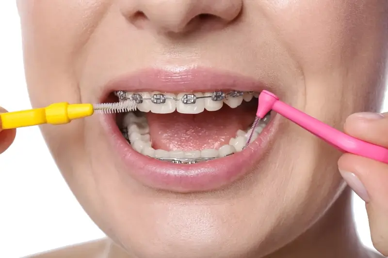 Dr Paweł Dobosz najlepsze implanty Szczecin